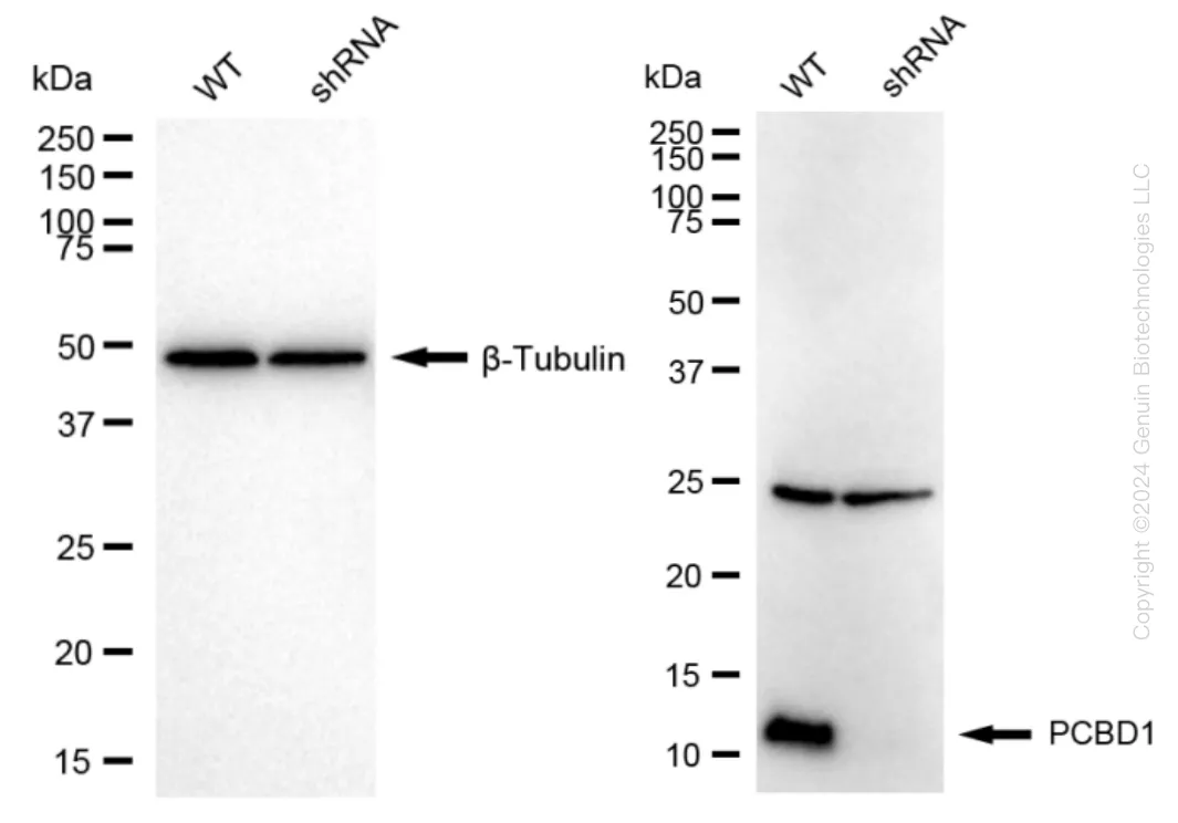PCBD1 Human Knockdown Lysate - image 1