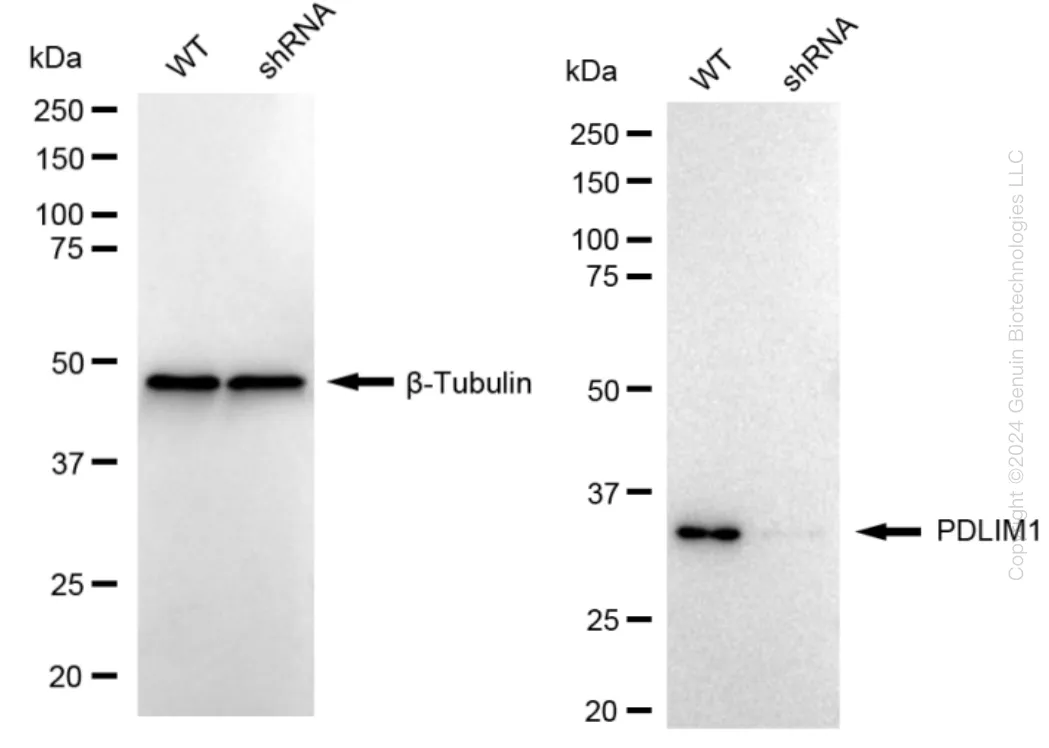 PDLIM1 Human Knockdown Lysate - image 1