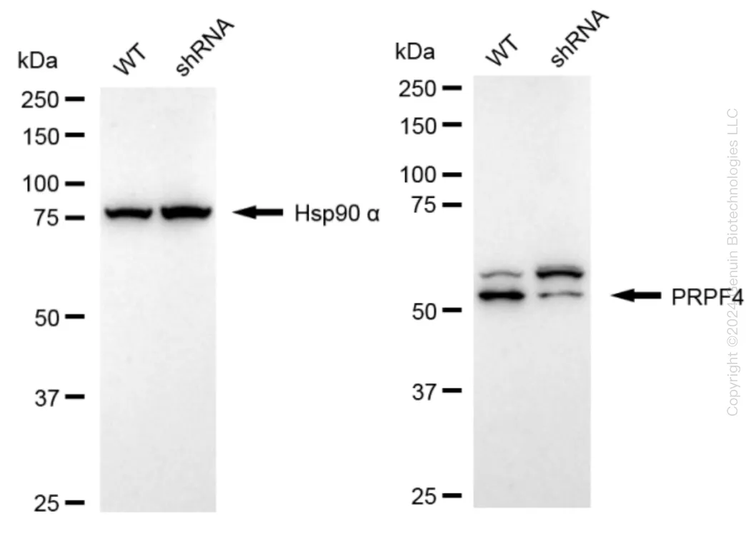 PRPF4 Human Knockdown Lysate - image 1