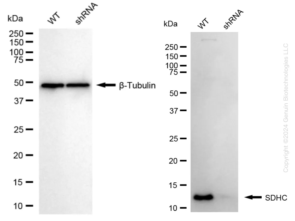 SDHC Human Knockdown Lysate - image 1