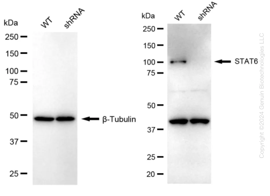 STAT6 Human Knockdown Lysate - image 1