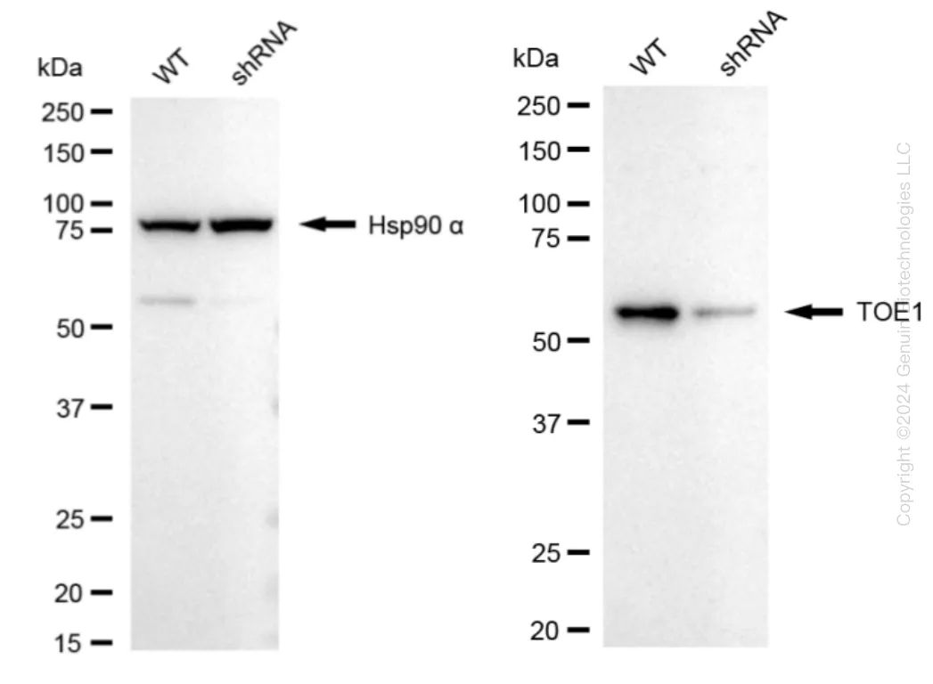 TOE1 Human Knockdown Lysate - image 1