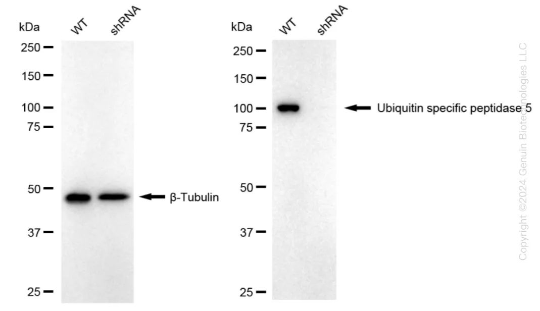 USP5 Human Knockdown Lysate - image 1