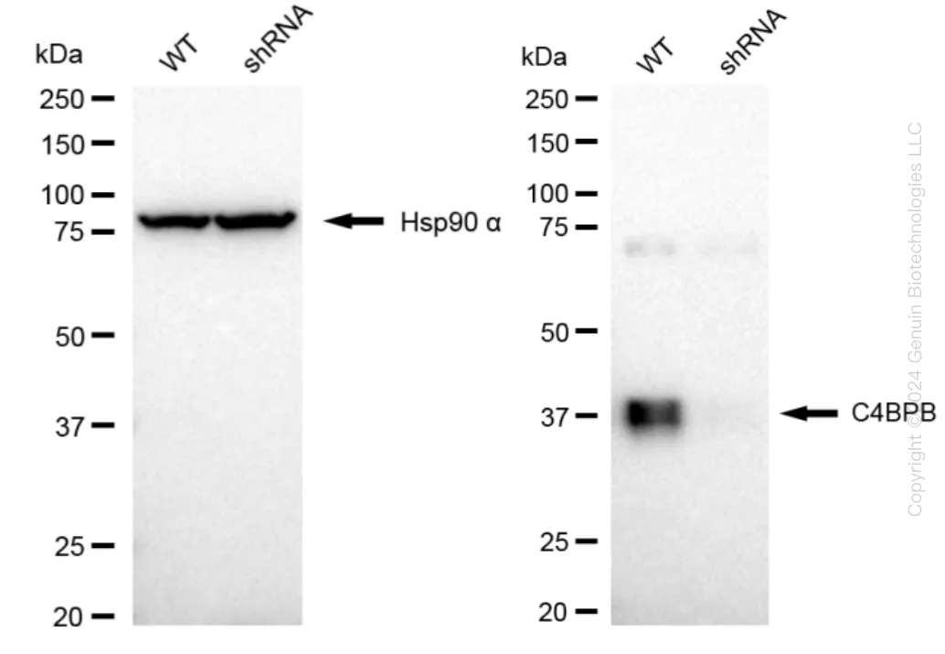 C4BPB Human Knockdown Lysate - image 1