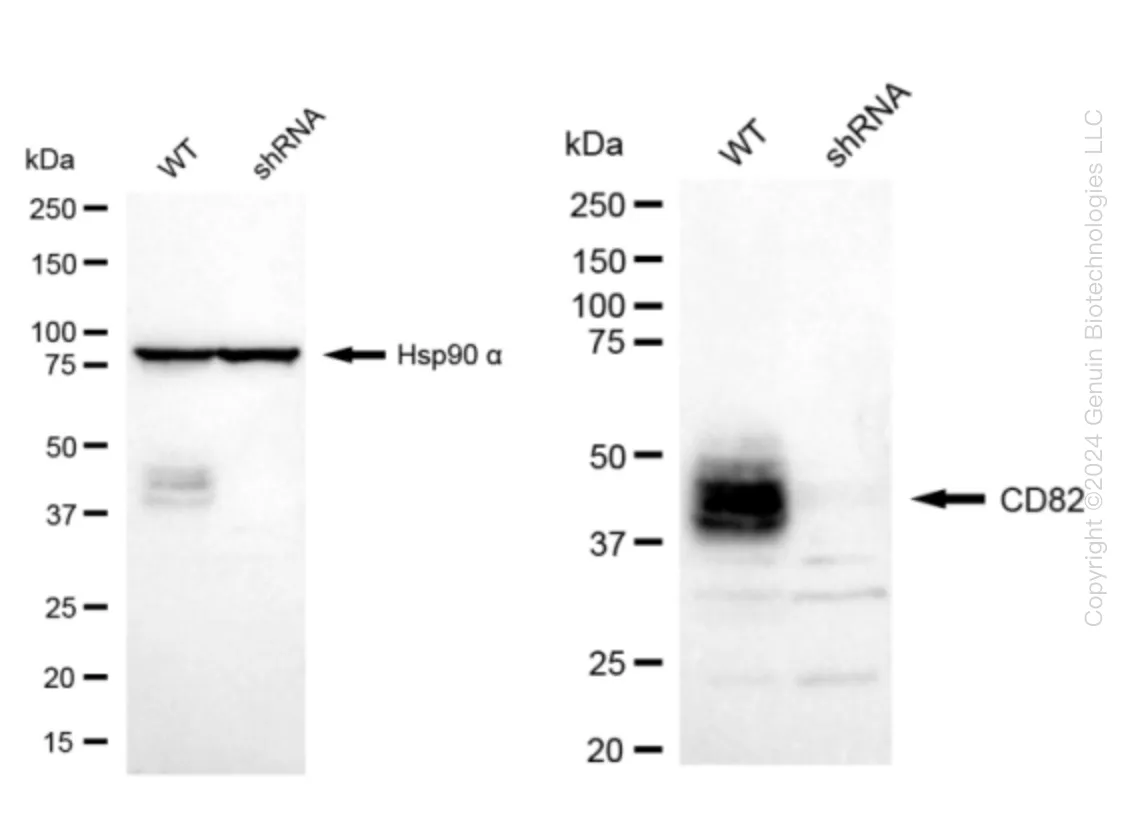 CD82 Human Knockdown Lysate - image 1
