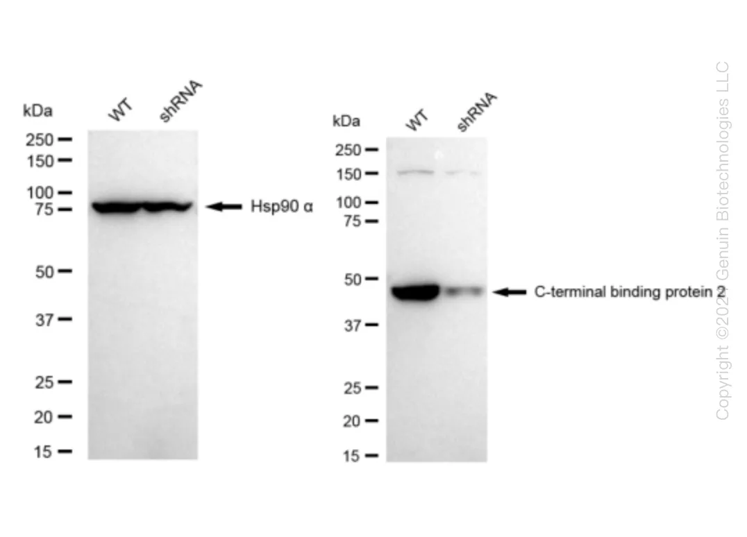 CTBP2 Human Knockdown Lysate - image 1