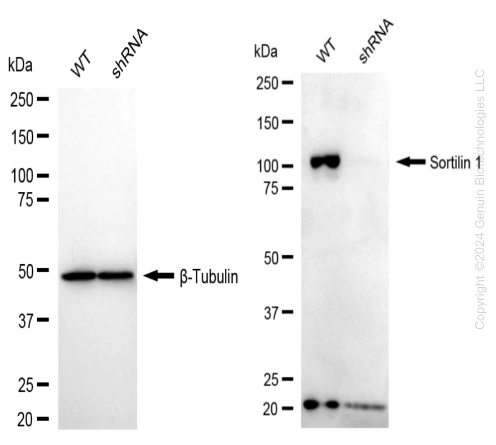 Sortilin (SORT1) Human Knockdown Lysate - image 1