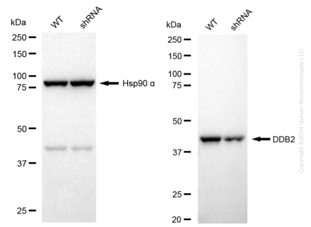 DDB2 Human Knockdown Lysate - image 1