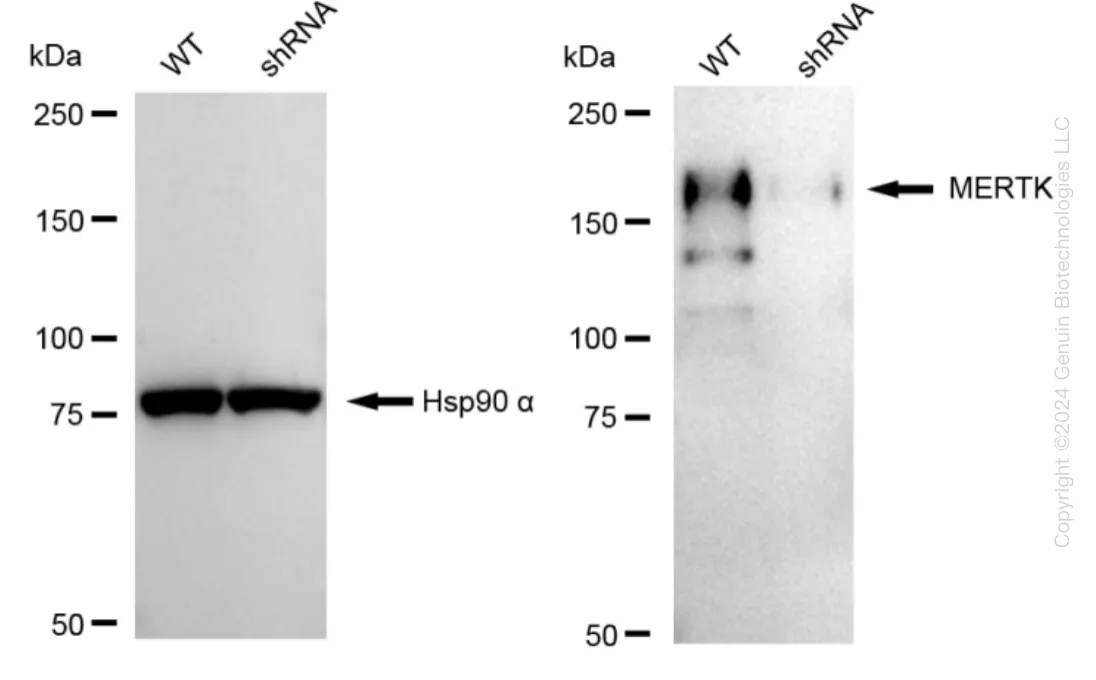 MERTK Human Knockdown Lysate - image 1