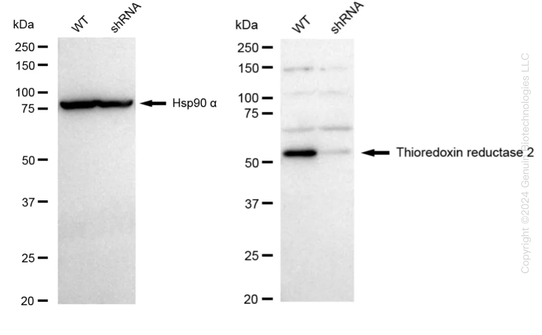 TXNRD2 Human Knockdown Lysate - image 1