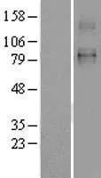 SLC26A2 (NM_000112) Human Over-expression Lysate - image 1