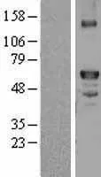 Factor X (F10) (NM_000504) Human Over-expression Lysate - image 1