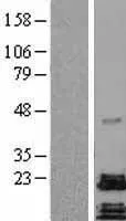 PACAP (ADCYAP1) (NM_001117) Human Over-expression Lysate - image 1