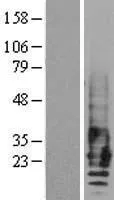 EMP2 (NM_001424) Human Over-expression Lysate - image 1