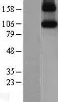 iNOS (NOS2) (NM_000625) Human Over-expression Lysate - image 1