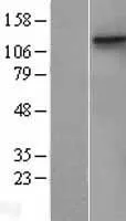 MCK10 (DDR1) (NM_001954) Human Over-expression Lysate - image 1