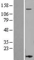 CD11a (ITGAL) (NM_002209) Human Over-expression Lysate - image 1
