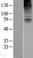 COL8A2 (NM_005202) Human Over-expression Lysate - image 1