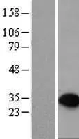 PTPRCAP (NM_005608) Human Over-expression Lysate - image 1