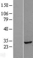 PHAPI2 / APRIL (ANP32B) (NM_006401) Human Over-expression Lysate - image 1