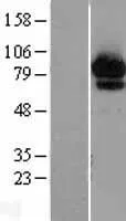 ABCF2 (NM_007189) Human Over-expression Lysate - image 1