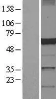 DCTN4 (NM_016221) Human Over-expression Lysate - image 1