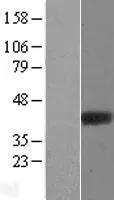 ARH3 (ADPRHL2) (NM_017825) Human Over-expression Lysate - image 1