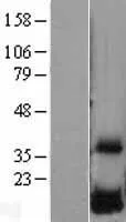 DUSP23 (NM_017823) Human Over-expression Lysate - image 1