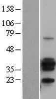 CD20 (MS4A1) (NM_021950) Human Over-expression Lysate - image 1