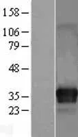 ITM2C (NM_030926) Human Over-expression Lysate - image 1