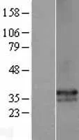 HLA DP (HLA-DPA1) (NM_033554) Human Over-expression Lysate - image 1
