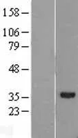 RDH11 (NM_016026) Human Over-expression Lysate - image 1