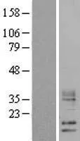 WFDC5 (NM_145652) Human Over-expression Lysate - image 1