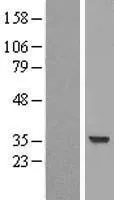 SuLT2A1 (NM_003167) Human Over-expression Lysate - image 1