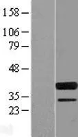 SPIB (NM_003121) Human Over-expression Lysate - image 1