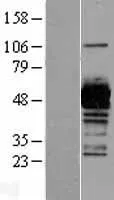 UAP1 (NM_003115) Human Over-expression Lysate - image 1