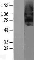 SCTR (NM_002980) Human Over-expression Lysate - image 1