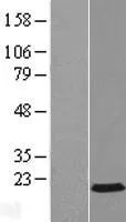 AP2S1 (NM_004069) Human Over-expression Lysate - image 1