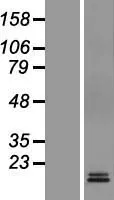 M6PR (NM_002355) Human Over-expression Lysate - image 1
