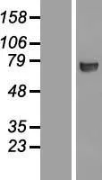CTP synthase (CTPS1) (NM_001905) Human Over-expression Lysate - image 1