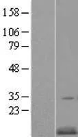 CKS2 (NM_001827) Human Over-expression Lysate - image 1