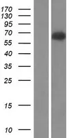 Complement C9 (C9) (NM_001737) Human Over-expression Lysate - image 1