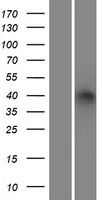 ADH6 (NM_001102470) Human Over-expression Lysate - image 1