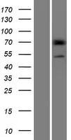 PRAMEF14 (NM_001099854) Human Over-expression Lysate - image 1