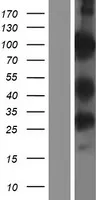 PWWP domain containing protein 2B (PWWP2B) (NM_001098637) Human Over-expression Lysate - image 1