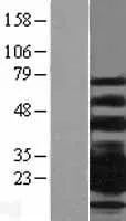 CD79B (NM_001039933) Human Over-expression Lysate - image 1
