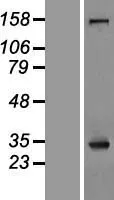 Nucleophosmin (NPM1) (NM_001037738) Human Over-expression Lysate - image 1