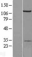 AP2B1 (NM_001030006) Human Over-expression Lysate - image 1