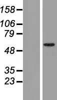 TRIM17 (NM_001024940) Human Over-expression Lysate - image 1