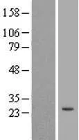 TRIM61 (NM_001012414) Human Over-expression Lysate - image 1